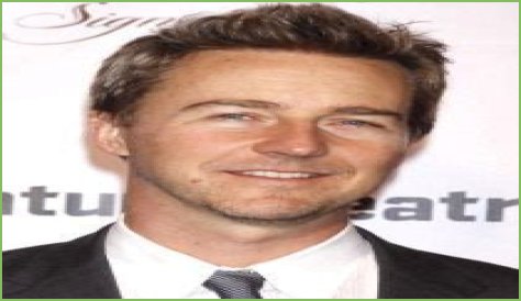Edward Norton Plastic Surgery Before and After