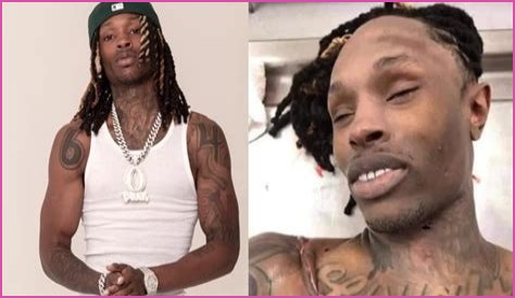 Unseen Autopsy Images Of King Von: The Tragic Aftermath Revealed